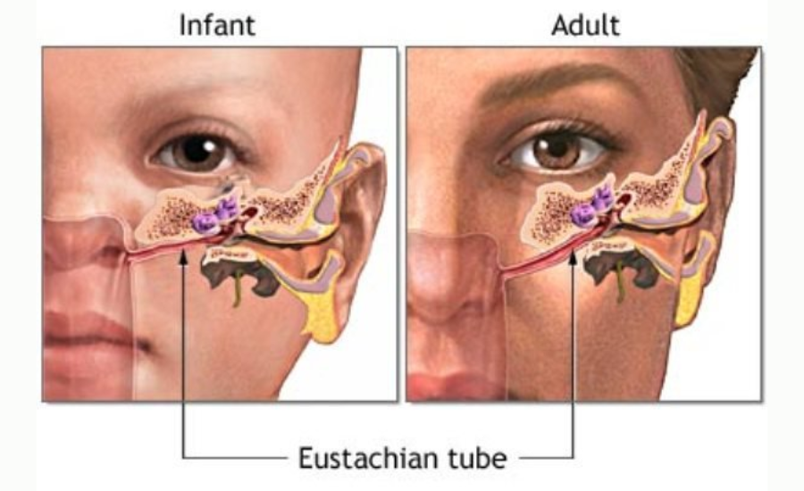 How Nutrition Can Help Prevent Eustachian Tube Dysfunction?